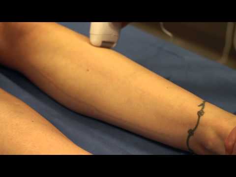 Epilator vs. Waxing : Waxing Tips & Tricks