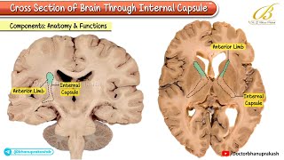 Cross Section of Brain Through Internal Capsule 🧠 Cadaveric Neuroanatomy | USMLE Step 1
