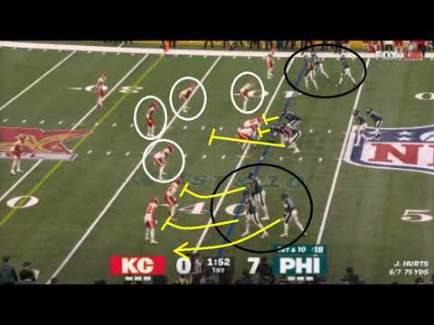Remember this weird play? | Super Bowl 59 | Kansas City Chiefs Vs Philadelphia Eagles