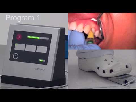 Calaject   Come funziona EN