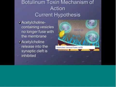 Brief Review of Movement Disorders 20121203 0350 1