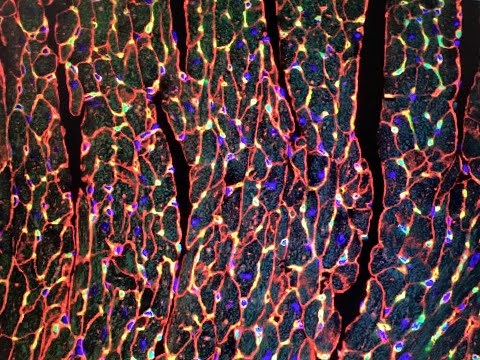 3 Minute Thesis: The Heart is like a Galaxy