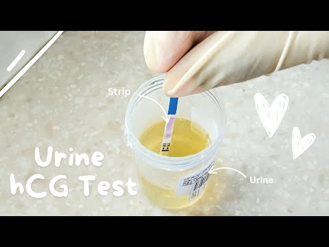 Urine hCG test 🌸🔬 How to run a pregnancy test | Pregnancy strip test for early testing | How to use