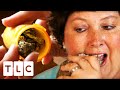 Woman Eats Up To 2 Lbs Of Rock A Day | My Strange Addiction
