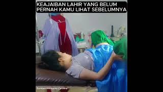 Download lagu KEAJAIBAN LAHIR YANG BELUM PERNAH KAMU LIHAT SEBELUMNYA! 🤯 (Perjuangan KELAHIRAN TAK TERPERCAYA!) mp3 Download lagu KEAJAIBAN LAHIR YANG BELUM PERNAH KAMU LIHAT SEBELUMNYA! 🤯 (Perjuangan KELAHIRAN TAK TERPERCAYA!) mp3