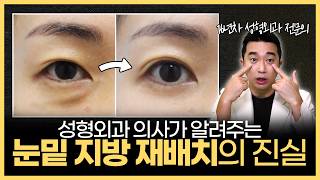 눈밑 지방 재배치, 이건 알고 하세요 | 눈밑지방, 눈밑처짐, 눈밑꺼짐