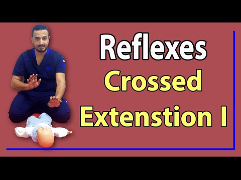 03 Crossed Extension Reflex I