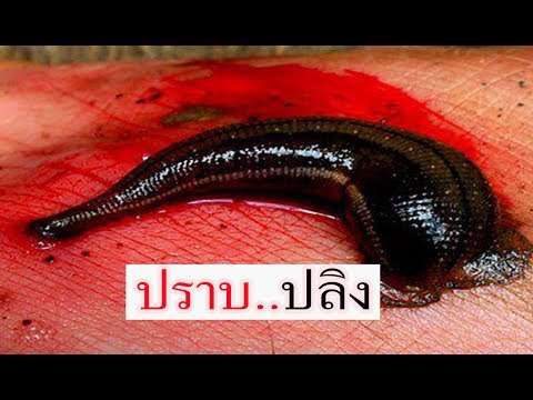 ในการรักษาโรคสะเก็ดเงินในข้อศอก Glucosamine และโรคสะเก็ดเงิน