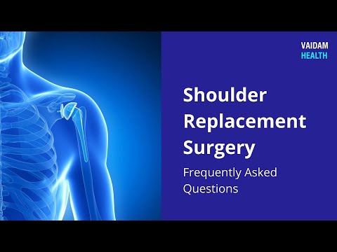 Shoulder Replacement - Frequently Asked Questions