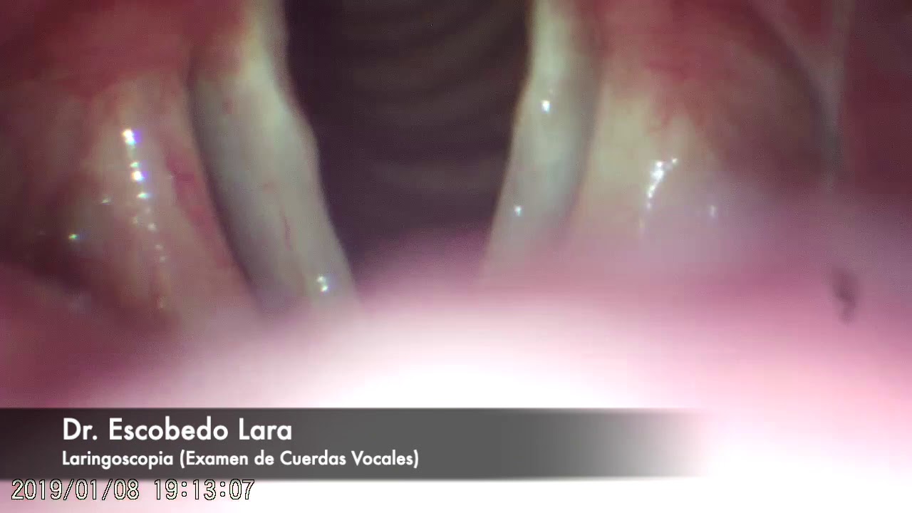 Javier Escobedo Lara-23