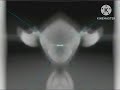 Klaskyklaskyklaskyklaksy Gummy Bear Song Version In G Major 67 G Major CoNfUsIoN