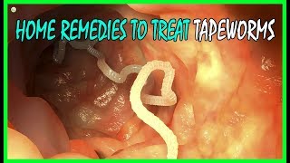 4 Effective Home Remedies To Treat Tapeworms In Humans | Best Home Remedies