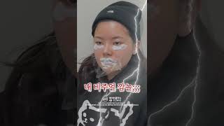 입술+애교필러로 동안 이미지 완성!