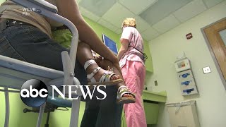 CDC issues new health alert on mysterious hepatitis outbreak in children | WNT