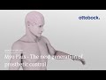Myo Plus Pattern Recognition - The next generation of prosthetic control | Ottobock