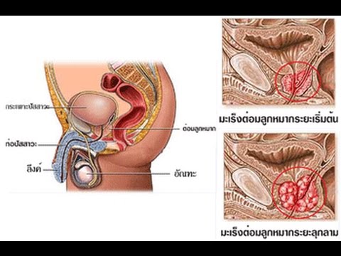 ซื้อกำไรแรง ครีมสำหรับอวัยวะเพศชายขยายอำนาจชีวิต