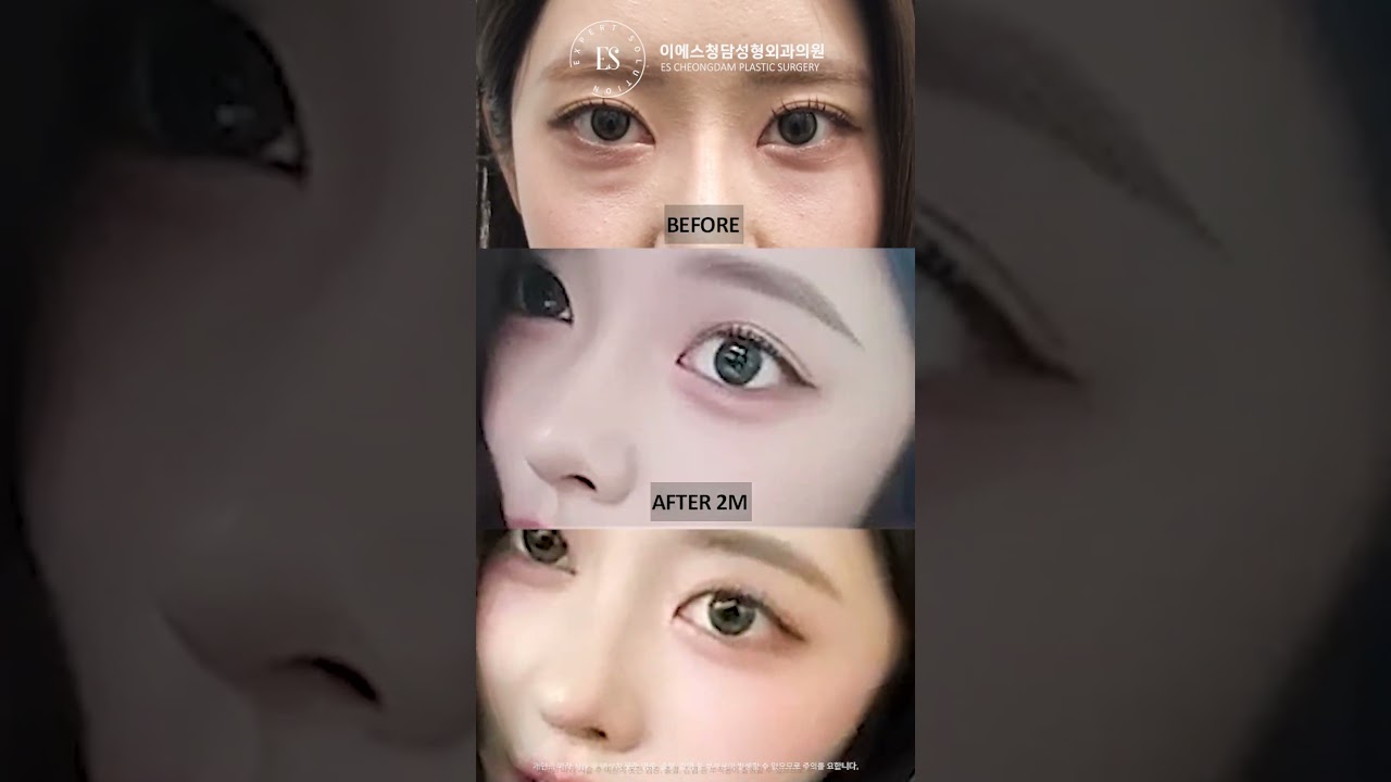 이에스 유튜브