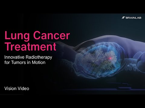 Lung Cancer Treatment – Innovative Radiotherapy for Tumors in Motion
