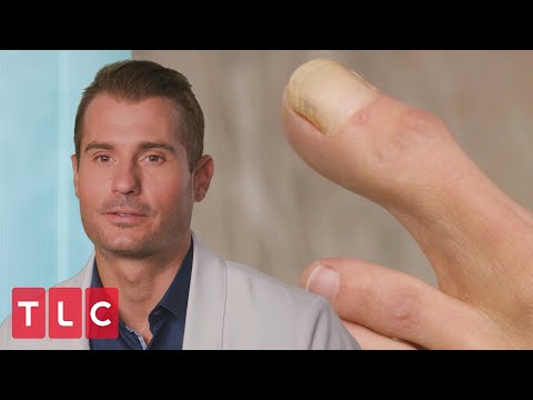 “Some of the Largest Toes I've Seen” | My Feet Are Killing Me