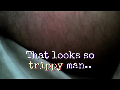 Extreme Leg Spasms | Looks Trippy | Rehabilitation Footage | Roadz Of Life Documentary (Short Clip)