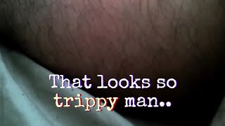Extreme Leg Spasms | Looks Trippy | Rehabilitation Footage | Roadz Of Life Documentary (Short Clip)