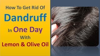 how to get rid of dandruff in one day with Lemon & Olive Oil
