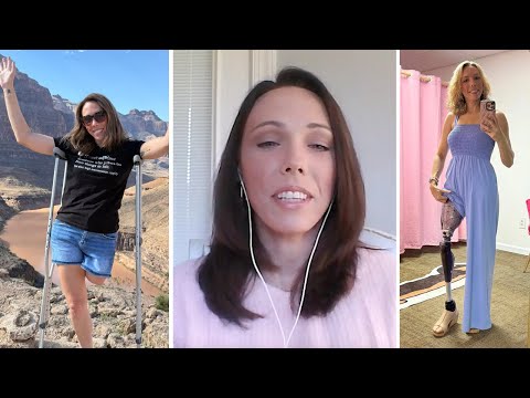 "Scariest day of my life": An amputee's physical & mental journey (Enable: The Disability Podcast)