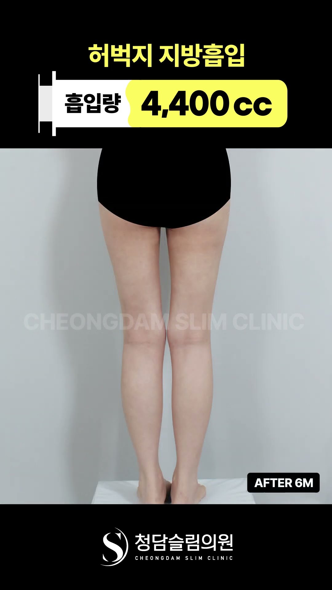 시원해진 계절, 지방도 가볍게 ✂️