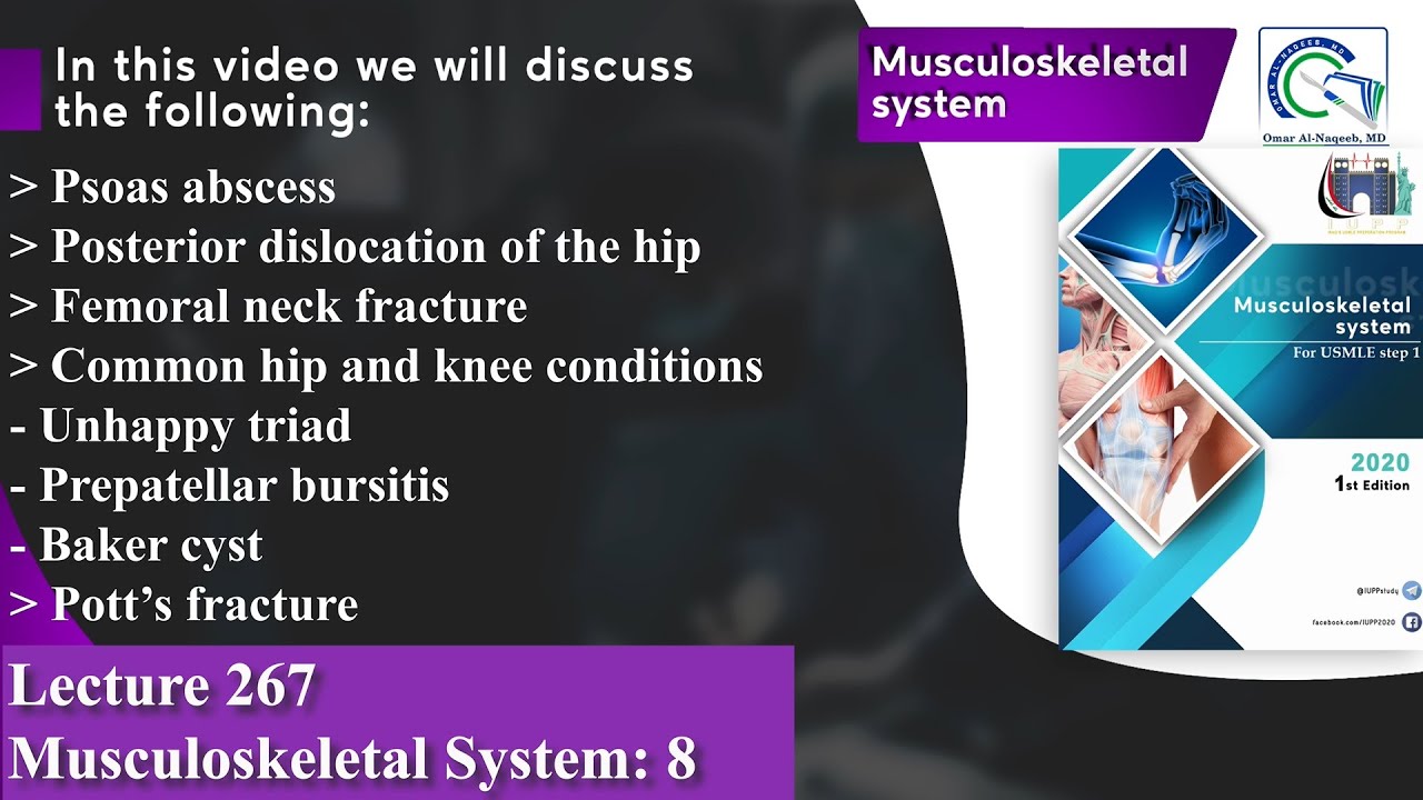 Psoas abscess| Hip dislocation | Femoral neck fracture| Unhappy triad | Baker cyst| Pott’s fracture