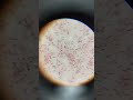 Lactobacillus Bacteria Under Microscope Bacteria In Curd