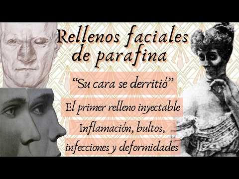 Relleno facial de parafina s. XX: "Su cara se derritió", ¿La historia se repite?, belleza peligr0sa.