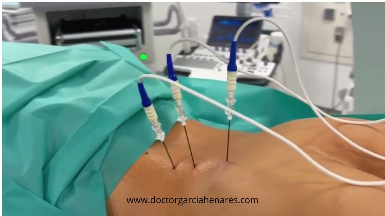 Juan Fernando García Henares-5