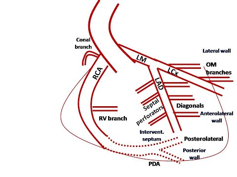 ECG course: Localization of Myocardial Ischemia, Dr. Sherif Altoukhy