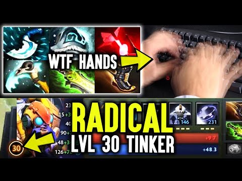 Radical LVL 30 Tinker With Crazy Skills - Unbelievable Finger Speed Of Tinker God Dota 2