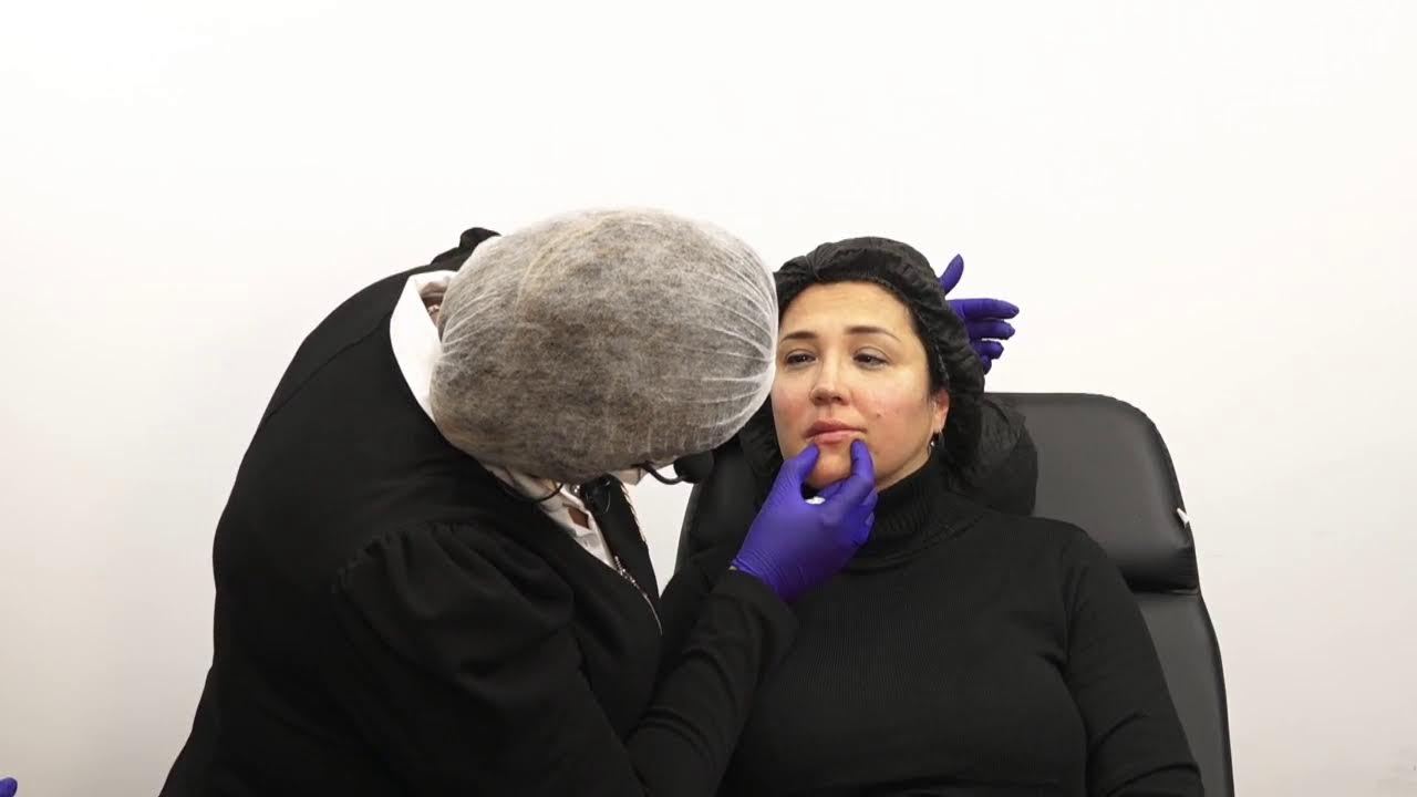 Preenchimento Facial