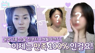 [윤곽 3종] 스트레스요? 이제는 만족 100%인걸요!