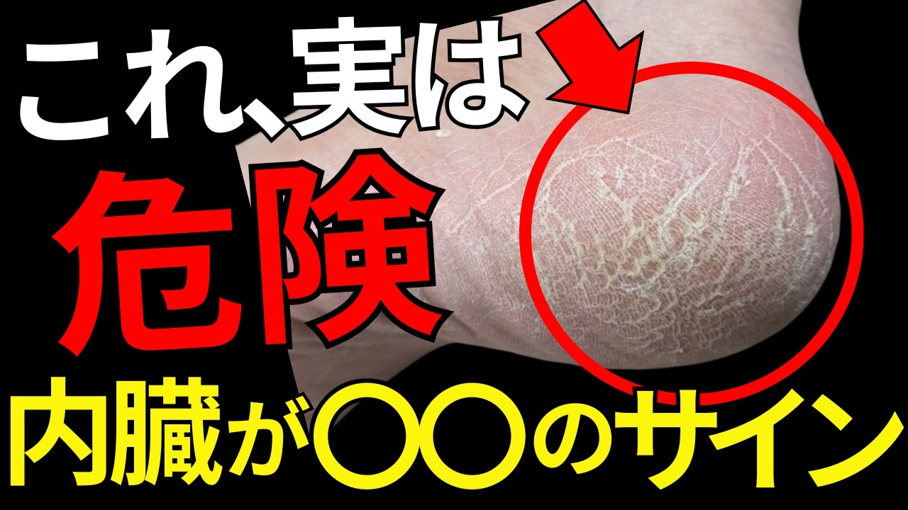 【乾燥ではなかった】踵のガサガサは内臓からのSOSサイン！隠れた病気を徹底解説