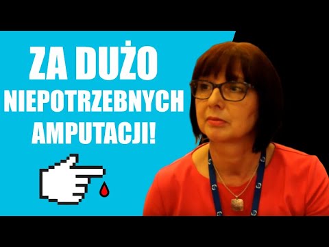 Jak pozbyć się palucha koślawego palucha Buty ortopedyczne koślawe dziecięce