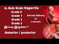 placental maturity grading in Tamil | Placenta grade 0 in Tamil | Grade 1 | Grade 2 | Grade 3