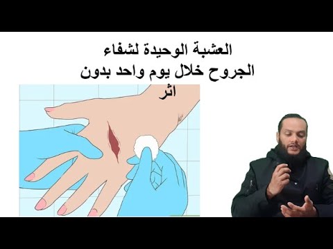 , title : 'ماهي عشبة مصاصة لجراح المشهورة با شفاء اي جرح خلال يوم واحد ؟'