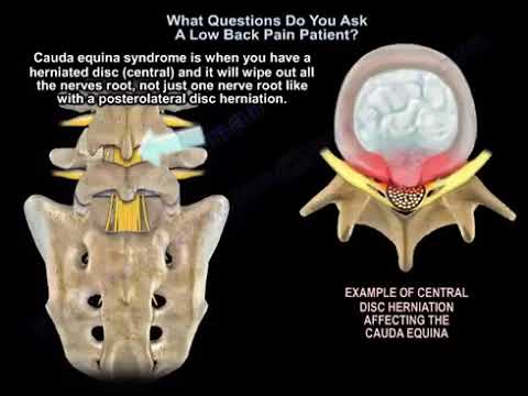 ¿Qué preguntas le haces a una paciente con dolor lumbar?