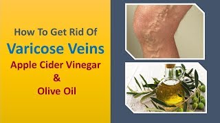 how to get rid of varicose veins naturally - Apple Cider Vinegar & Olive Oil