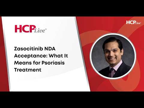 Zasocitinib NDA Acceptance: What It Means for Psoriasis ...