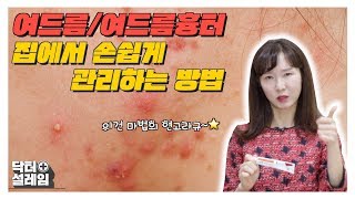 여드름/여드름 흉터 집에서 손쉽게 관리하는 방법!!!