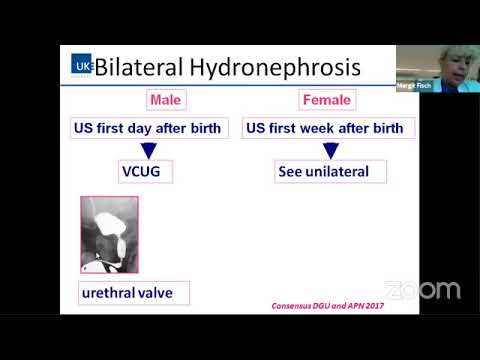 paediatric case based discussion - Moderated Dr Anil Takvani