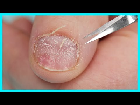 Cuticle-Cutting? ✅OR ❌