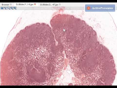 Histo-Prof Teil 7: Lymphknoten