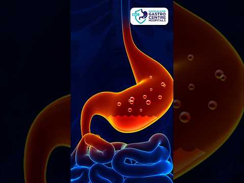 ⚠️ 5 Alarming GERD Symptoms You Should NEVER Ignore! 🚨