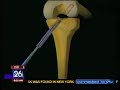 Dr. Harvey discusses knee injuries in girls playing soccer on Fox 26's Morning News Fox 26 Houston - Dr. Harvey