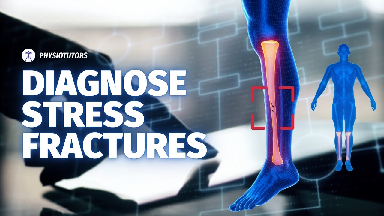 Medial Tibial Stress Fracture Algorithm | Differential Diagnosis